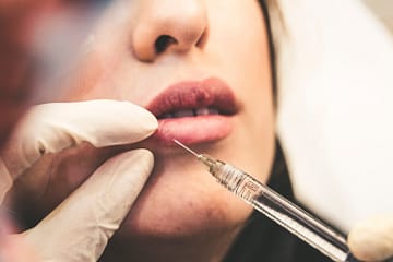 can botox be reversed?