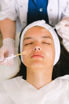 How To Properly Care For Skin After a Chemical Peel