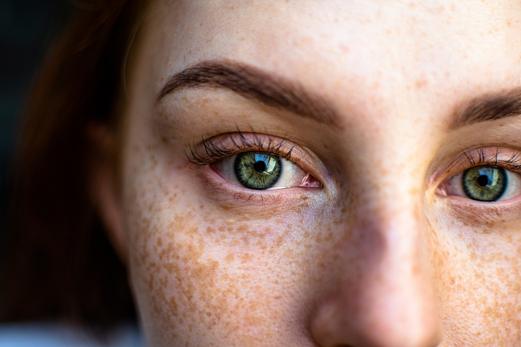 At Home Treatments For Hyperpigmentation